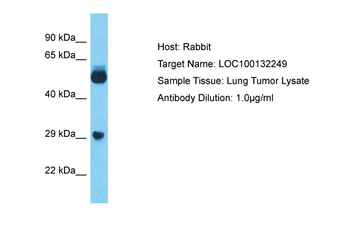 LOC100132249 Rabbit Polyclonal Antibody