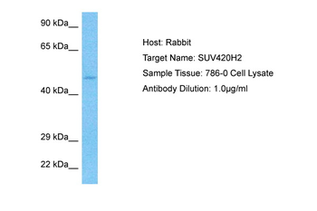 KMT5C Rabbit Polyclonal Antibody