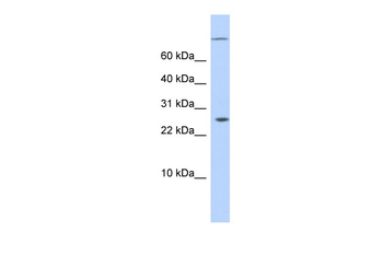 ARID5A Rabbit Polyclonal Antibody