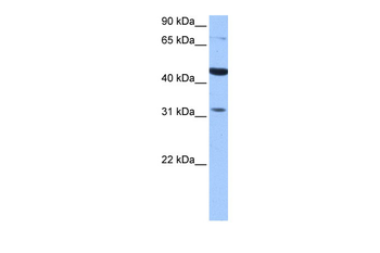 TPRXL Rabbit Polyclonal Antibody