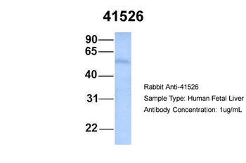 SEPT9 Rabbit Polyclonal Antibody