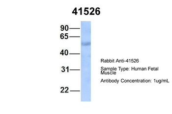SEPT9 Rabbit Polyclonal Antibody