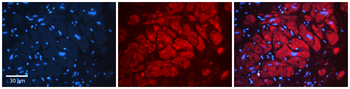 SEPT9 Rabbit Polyclonal Antibody