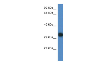Gm527 Rabbit Polyclonal Antibody