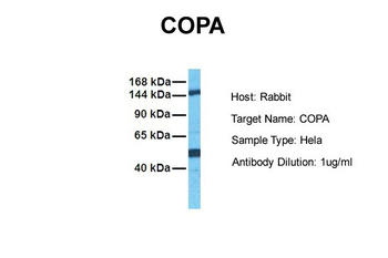 COPA Rabbit Polyclonal Antibody