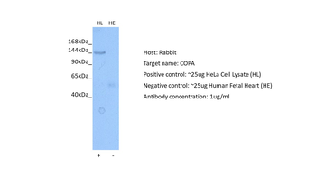 COPA Rabbit Polyclonal Antibody