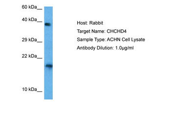 CHCHD4 Rabbit Polyclonal Antibody