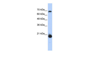 CHCHD4 Rabbit Polyclonal Antibody