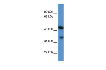Centa1 Rabbit Polyclonal Antibody