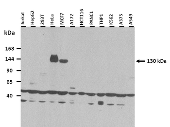 FILIP1L Rabbit Polyclonal Antibody
