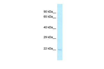 Tsen15 Rabbit Polyclonal Antibody