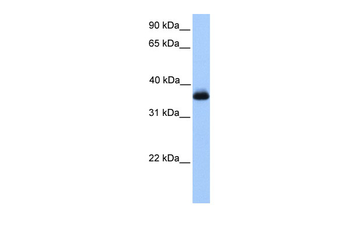 ERI2 Rabbit Polyclonal Antibody