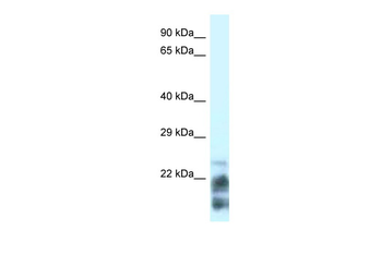 MDP-1 Rabbit Polyclonal Antibody