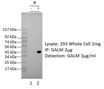 GALM Rabbit Polyclonal Antibody