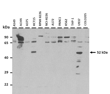ALS2CR12 Rabbit Polyclonal Antibody