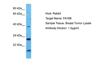 FAM76B Rabbit Polyclonal Antibody