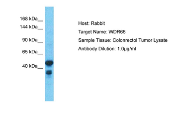 WDR66 Rabbit Polyclonal Antibody