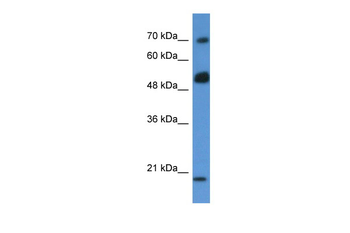 ARHGAP36 Rabbit Polyclonal Antibody