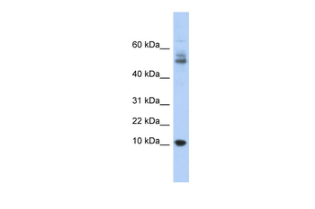 MTPN Rabbit Polyclonal Antibody