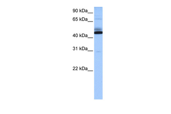 TMEM266 Rabbit Polyclonal Antibody