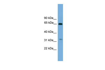 UBXD3 Rabbit Polyclonal Antibody