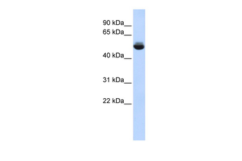 TRAM1L1 Rabbit Polyclonal Antibody