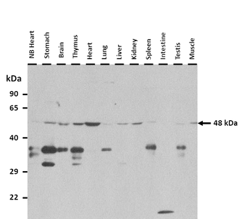Lacc1 Rabbit Polyclonal Antibody