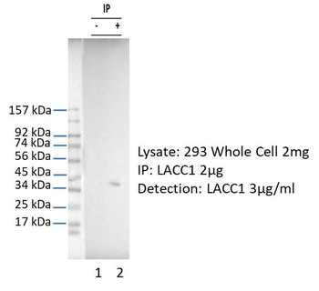 Lacc1 Rabbit Polyclonal Antibody