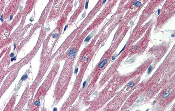 PLEKHH2 Rabbit Polyclonal Antibody