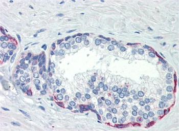 PLEKHH2 Rabbit Polyclonal Antibody