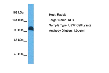 KLB Rabbit Polyclonal Antibody