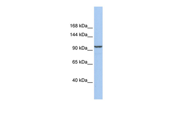 KLB Rabbit Polyclonal Antibody