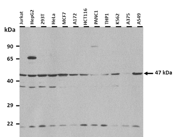 ASB6 Rabbit Polyclonal Antibody