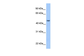 ASB6 Rabbit Polyclonal Antibody