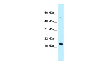 1110059E24Rik Rabbit Polyclonal Antibody