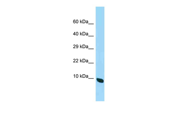 Micos13 Rabbit Polyclonal Antibody