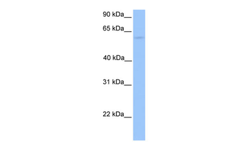 CCT6B Rabbit Polyclonal Antibody
