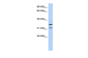 C17orf81 Rabbit Polyclonal Antibody