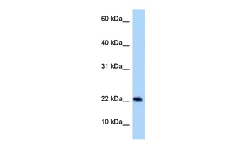 SPACA9 Rabbit Polyclonal Antibody