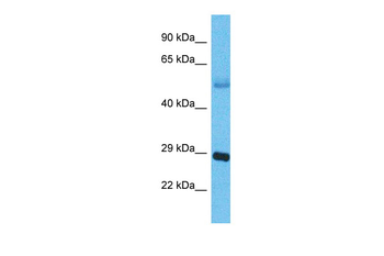 APH1B Rabbit Polyclonal Antibody