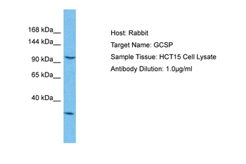 GLDC Rabbit Polyclonal Antibody
