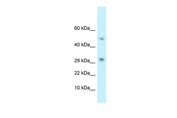 D9Ertd402e Rabbit Polyclonal Antibody