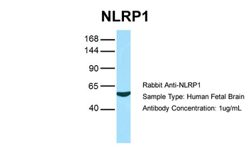 NLRP1 Rabbit Polyclonal Antibody