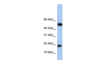 LOC285033 Rabbit Polyclonal Antibody