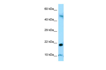 AMELY Rabbit Polyclonal Antibody