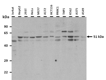 FKBP5 Rabbit Polyclonal Antibody