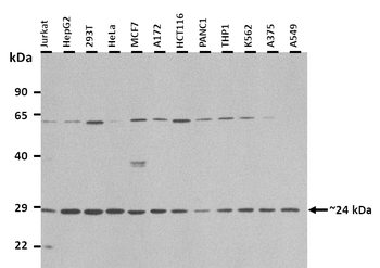 METTL5 Rabbit Polyclonal Antibody