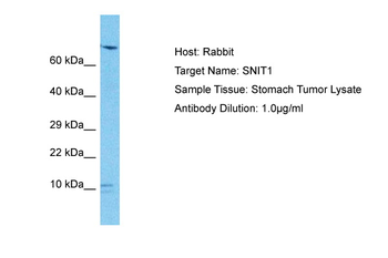 SND1-IT1 Rabbit Polyclonal Antibody