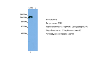 KIAA0182 Rabbit Polyclonal Antibody