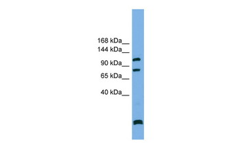 PPP6R1 Rabbit Polyclonal Antibody